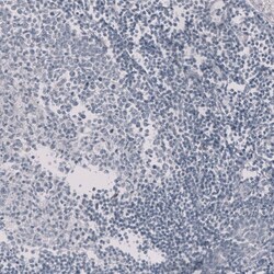 HE4/WFDC2 Antibody (CL12917) - Azide and BSA Free, Novus Biologicals 100