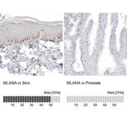 Melan-A/MART-1 Antibody (CL12874) - Azide and BSA Free, Novus Biologicals