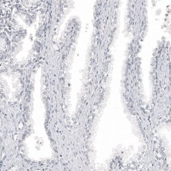 Melan-A/MART-1 Antibody (CL12874) - Azide and BSA Free, Novus Biologicals