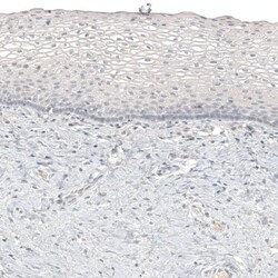 Melan-A/MART-1 Antibody (CL12863) - Azide and BSA Free, Novus Biologicals