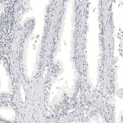 Melan-A/MART-1 Antibody (CL12863) - Azide and BSA Free, Novus Biologicals