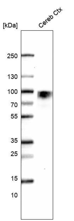Nectin-3/PVRL3 Antibody (CL15364) - Azide and BSA Free, Novus Biologicals 100 &mu;L | Buy Online | Novus Biologicals | Fisher Scientific