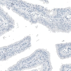 OTP Antibody (CL11225) - Azide and BSA Free, Novus Biologicals 100 ul;
