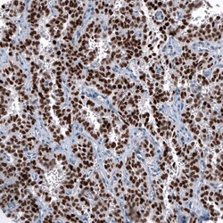 OTP Antibody (CL11225) - Azide and BSA Free, Novus Biologicals 100 ul;