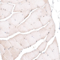 ROR2 Antibody (CL5950) - Azide and BSA Free, Novus Biologicals 100 ul;