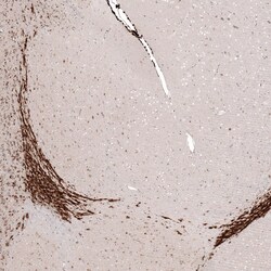 SOX4 Antibody (CL5634) - Azide and BSA Free, Novus Biologicals 100 ul;