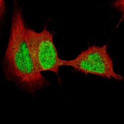 SOX4 Antibody (CL5665) - Azide and BSA Free, Novus Biologicals 100 ul;