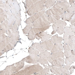 myosin X Antibody (CL9032) - Azide and BSA Free, Novus Biologicals 100