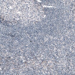 G6PC Antibody (CL5817) - Azide and BSA Free, Novus Biologicals 100 ul;