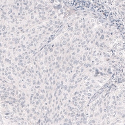 Nanog Antibody (CL5803) - Azide and BSA Free, Novus Biologicals 100 ul;