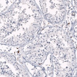 HLA DRA Antibody (CL10964) - Azide and BSA Free, Novus Biologicals 100