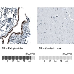 Androgen R/NR3C4 Antibody (CL9255) - Azide and BSA Free, Novus Biologicals 100 &mu;L | Buy Online | Novus Biologicals | Fisher Scientific