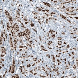 Androgen R/NR3C4 Antibody (CL9255) - Azide and BSA Free, Novus Biologicals 100 &mu;L | Buy Online | Novus Biologicals | Fisher Scientific