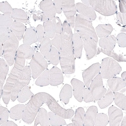 KLF4 Antibody (CL5785) - Azide and BSA Free, Novus Biologicals 100 ul;