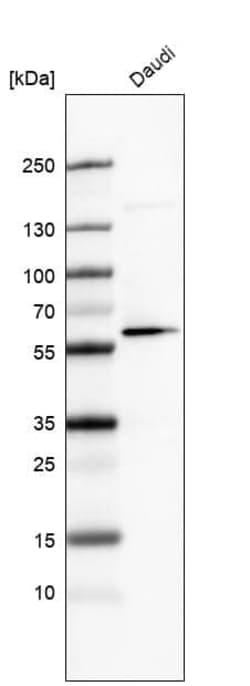 GLS2 Antibody (CL7721) - Azide and BSA Free, Novus Biologicals 100 ul;