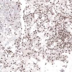 NFkB2/NFkB p100 Antibody (CL8266) - Azide and BSA Free, Novus Biologicals