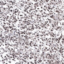 NFkB2/NFkB p100 Antibody (CL8266) - Azide and BSA Free, Novus Biologicals