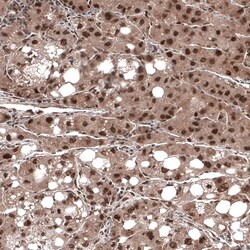 CDK4 Antibody (CL8102) - Azide and BSA Free, Novus Biologicals 100 ul;