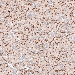 SOX6 Antibody (CL5690) - Azide and BSA Free, Novus Biologicals 100 ul;