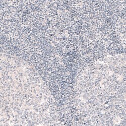 SOX6 Antibody (CL5690) - Azide and BSA Free, Novus Biologicals 100 ul;