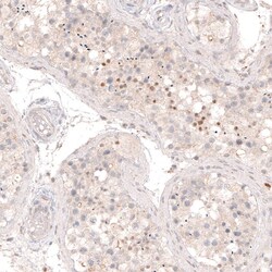 SOX6 Antibody (CL5690) - Azide and BSA Free, Novus Biologicals 100 ul;