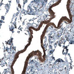 Smad2 Antibody (CL8472) - Azide and BSA Free, Novus Biologicals 100 ul;