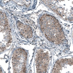 Smad2 Antibody (CL8472) - Azide and BSA Free, Novus Biologicals 100 ul;