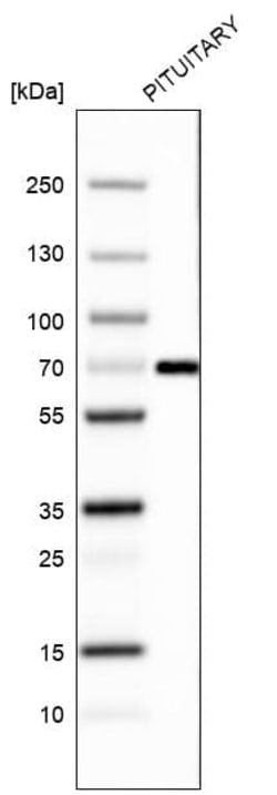 ZNF10 Antibody (CL9744) - Azide and BSA Free, Novus Biologicals 100 ul;