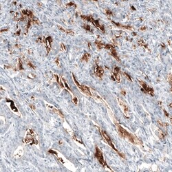 MUC5AC Antibody (CL8961) - Azide and BSA Free, Novus Biologicals 100 ul;