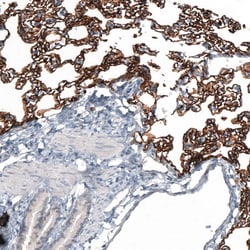 AGER Antibody (CL10587) - Azide and BSA Free, Novus Biologicals 100 ul;