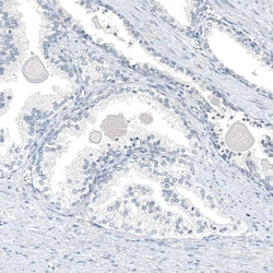 AGER Antibody (CL10587) - Azide and BSA Free, Novus Biologicals 100 ul;