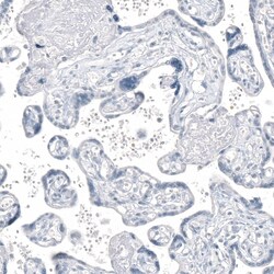 AGER Antibody (CL10587) - Azide and BSA Free, Novus Biologicals 100 ul;