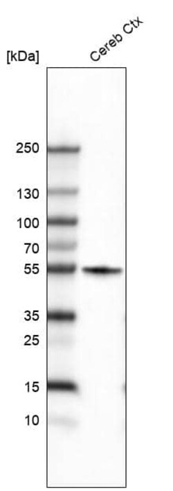 beta-III Tubulin Antibody (CL5814) - Azide and BSA Free, Novus Biologicals 100 &mu;L | Buy Online | Novus Biologicals | Fisher Scientific
