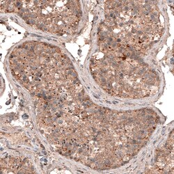 LAPTM4B Antibody (CL5287) - Azide and BSA Free, Novus Biologicals 100 ul;