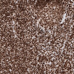 Histone H2AY/macroH2A.1 Antibody (CL5245) - Azide and BSA Free, Novus Biologicals