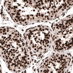 HIST1H3A Antibody (CL4967) - Azide and BSA Free, Novus Biologicals 100