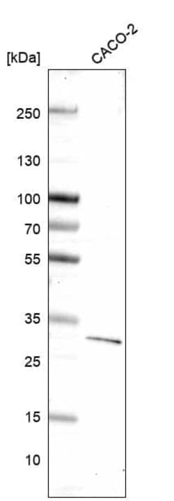 Dkk-1 Antibody (CL14707) - Azide and BSA Free, Novus Biologicals 100 ul;