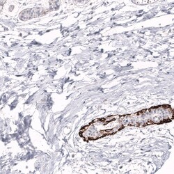 Cytokeratin 14 Antibody (CL14568) - Azide and BSA Free, Novus Biologicals