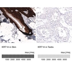 Cytokeratin 14 Antibody (CL14568) - Azide and BSA Free, Novus Biologicals