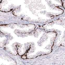 Cytokeratin 14 Antibody (CL14568) - Azide and BSA Free, Novus Biologicals