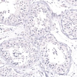 Cytokeratin 14 Antibody (CL14568) - Azide and BSA Free, Novus Biologicals