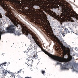 Cytokeratin 14 Antibody (CL14568) - Azide and BSA Free, Novus Biologicals