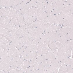 Myeloperoxidase/MPO Antibody (CL14976) - Azide and BSA Free, Novus Biologicals 100 &mu;L | Buy Online | Novus Biologicals | Fisher Scientific