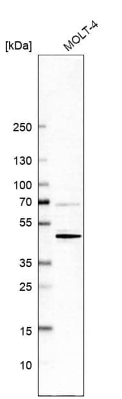 CD5 Antibody (CL12420) - Azide and BSA Free, Novus Biologicals 100 ul;