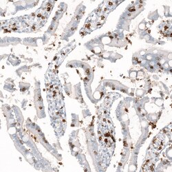 CD5 Antibody (CL12420) - Azide and BSA Free, Novus Biologicals 100 ul;