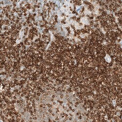 CD5 Antibody (CL12420) - Azide and BSA Free, Novus Biologicals 100 ul;