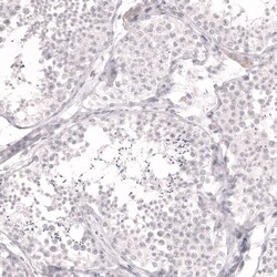 Lactase Antibody (CL14122) - Azide and BSA Free, Novus Biologicals 100