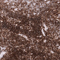 CD19 Antibody (CL15454) - Azide and BSA Free, Novus Biologicals 100 ul;