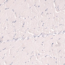 TTF-1/ NKX2-1 Antibody (CL14531) - Azide and BSA Free, Novus Biologicals