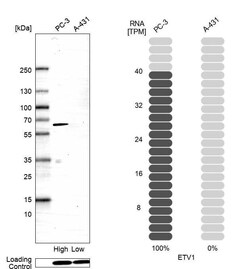 ETV1 Antibody (CL15257) - Azide and BSA Free, Novus Biologicals 100 ul;